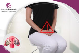 ما سبب تكيس المبيض