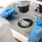 عملية الحقن المجهري