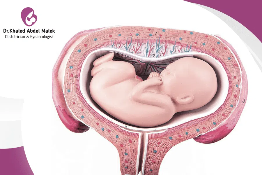 الخدمات 11 علاج المشيمة الملتصقة