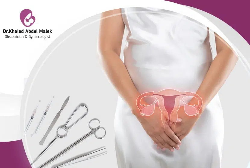 استئصال الرحم والدورة الشهرية والعلاقة بينهما 1 استئصال الرحم والدورة الشهرية