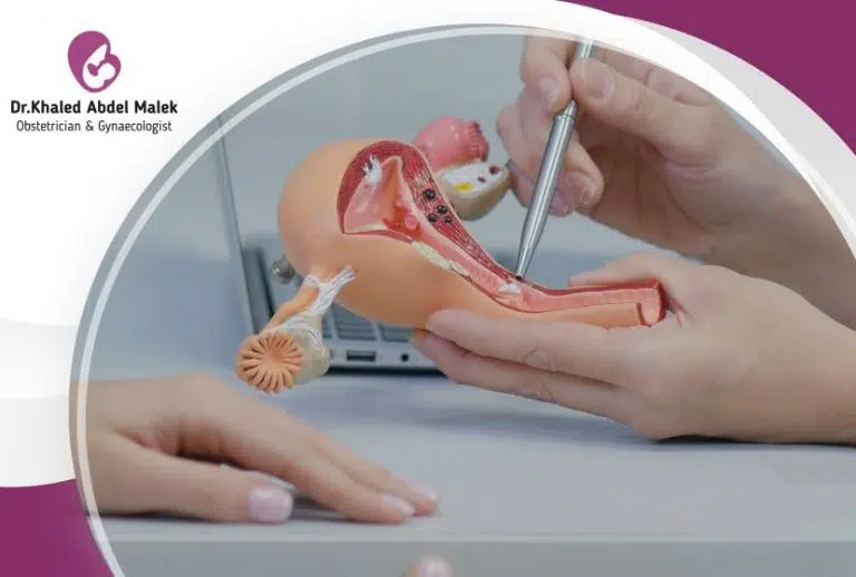 عملية استئصال الرحم بالمنظار: الدليل الشامل للجراحة 1 عملية استئصال الرحم بالمنظار