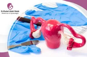 هل استئصال الرحم يسبب زيادة الوزن؟ 3 تكلفة عملية استئصال الرحم فى مصر