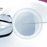 افضل دكتور حقن مجهري في مصر