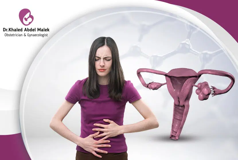 تكيس المبايض