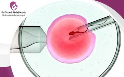 طريقة الحقن المجهري للحمل بعد الإجهاض، هل يمكنني إعادة الكَّرة؟