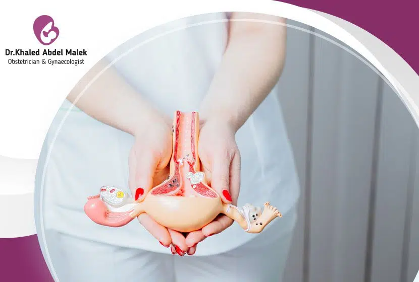 علاج تليف الرحم، وهل الورم الليفي خطر؟ 1 علاج تليف الرحم