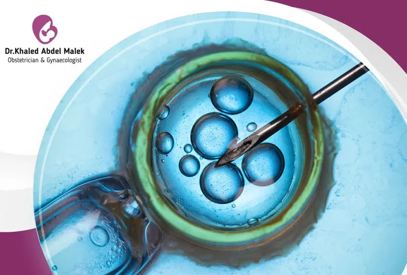 خطوات عملية اطفال الانابيب