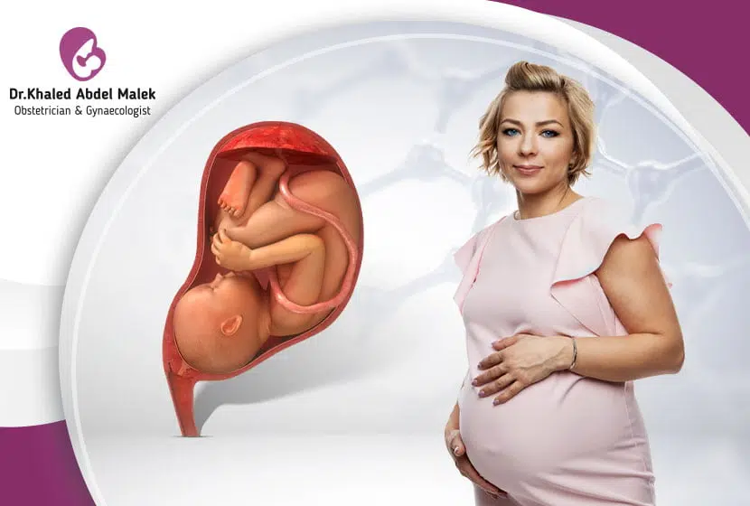 شكل المشيمة الطبيعي