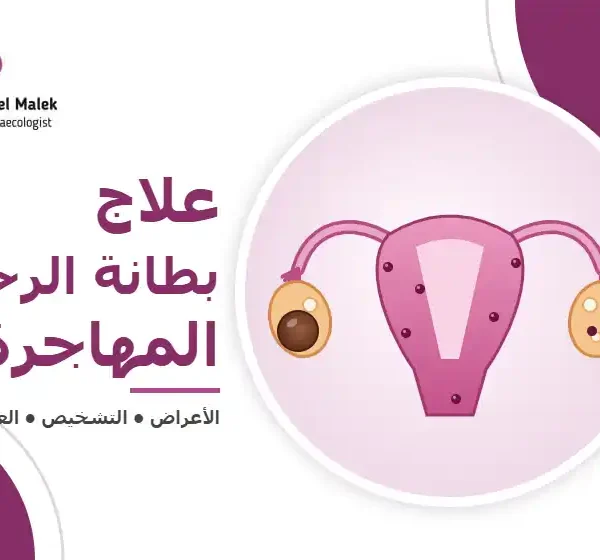 الرئيسية 9 دليل علاج بطانة الرحم المهاجرة: الأعراض والتشخيص والعلاج دكتور خالد عبد الملك